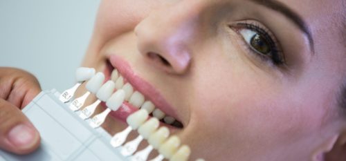 Gain Confidence Through Tooth Replacement