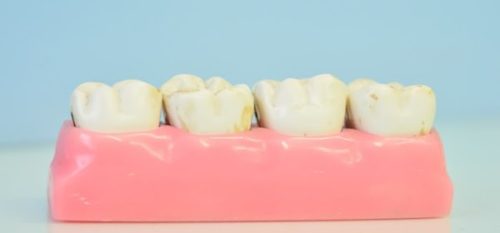Truths Behind The Top 8 Dental Myths