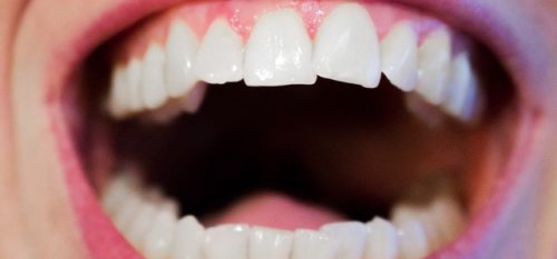 Top 5 Signs Of Good Oral Health
