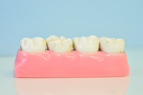 gums and teeth