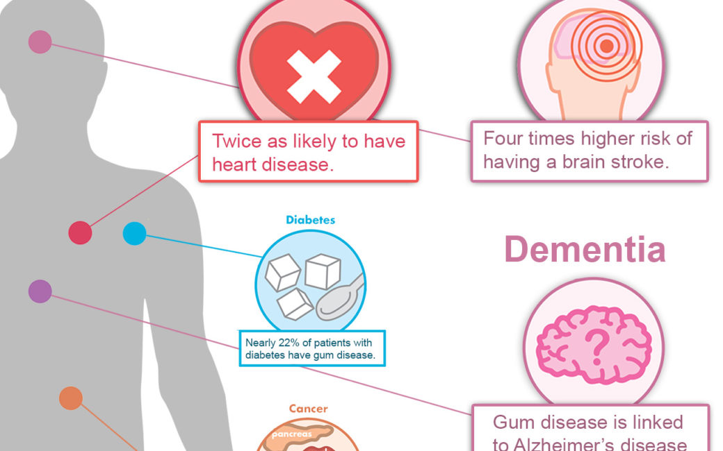 Gum Disease and Total Health