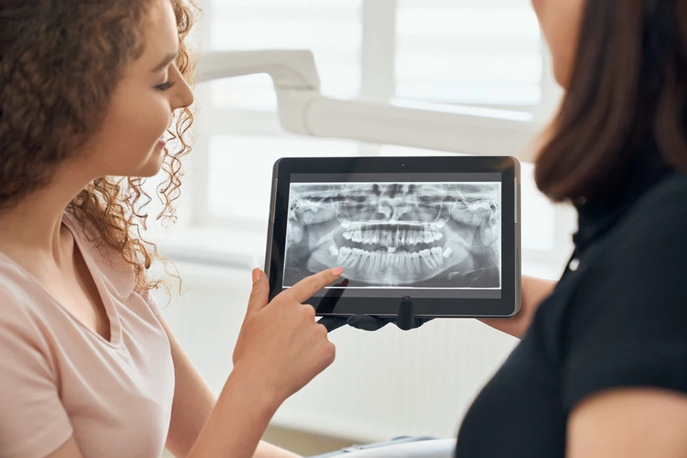 digital x-ray