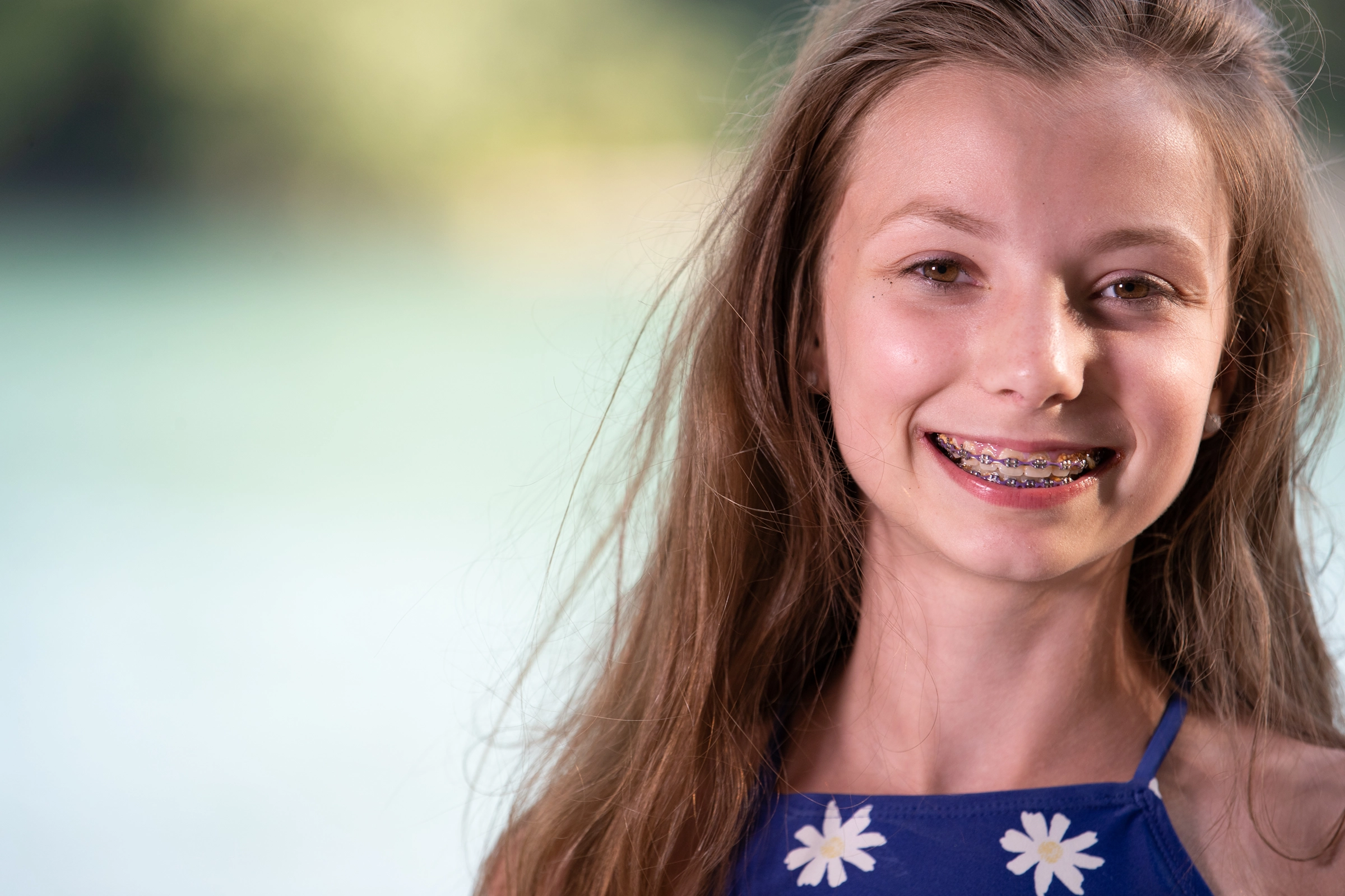 teen girl smiling with braces