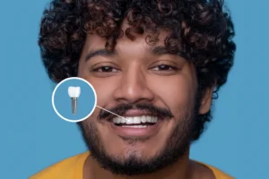 dental implant vs bridge vs dentures