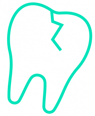 5c61cc9bda78f06e03dce43b_noun_cracked-tooth_245460-2-530x650